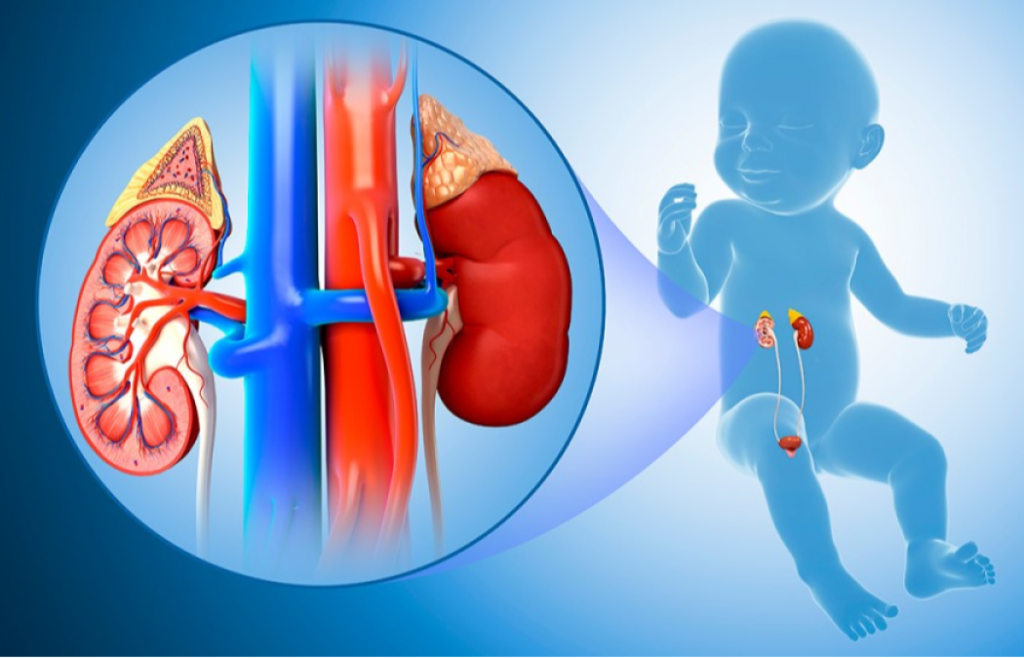 Medical illustration of a baby with highlighted kidneys, ureters and bladder, alongside a close‑up cross‑section of the kidney and adrenal gland, representing congenital kidney and urinary tract problems in children treated by pediatric urologist Dr. Pritesh Shrimali in Indore.