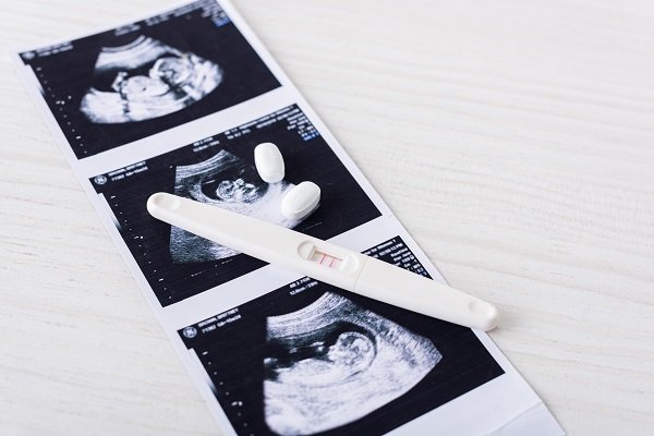 Positive pregnancy test placed on top of a strip of fetal ultrasound images with a few white tablets nearby, representing confirmed pregnancy and the need for safe, doctor‑guided medicines for infections such as urinary tract infections in pregnancy, managed in Indore by urologist Dr. Pritesh Shrimali.